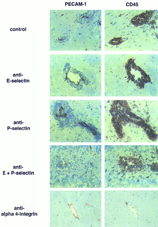 Fig. 6. Anti–E- and anti–P-selectin antibodies do not influence the development of EAE. Inflammatory cuffs in the CNS of mice afflicted with EAE are shown. Left panel: staining of vessels with anti-PECAM-1/CD31; right panel: staining of leukocytes with anti-CD45. Inflammatory cuffs develop in rat IgG-treated (control) EAE animals but also in presence of anti–E- or anti–P-selectin or both MoAbs. In contrast, in animals treated with anti–α4-integrin, MoAb inflammatory cuffs cannot be detected. Single CD45+ cells adjacent to the vessels can also be seen in the healthy CNS and are most probably perivascular macrophages. Immunoperoxidase staining, hematoxylin counterstain. Original magnification × 200.
