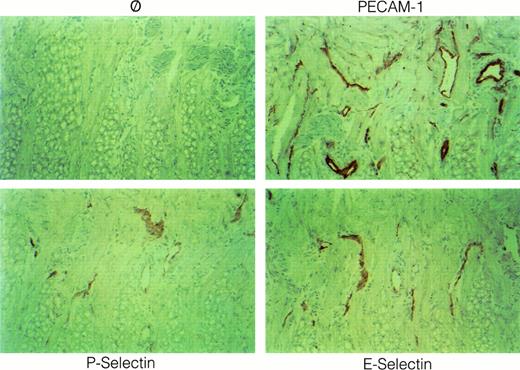 Fig. 7. E- and P-selectin expression can be induced in peripheral vessels outside the CNS after injection of LPS or TNF-α. Immunoperoxidase staining for E- and P-selectin in the tongue of a SJL/J mouse 4 hours after injection of 50 μg LPS is shown. ⊘, isotype matched control. Immunoperoxidase staining, hematoxylin counterstain. Original magnification × 420.
