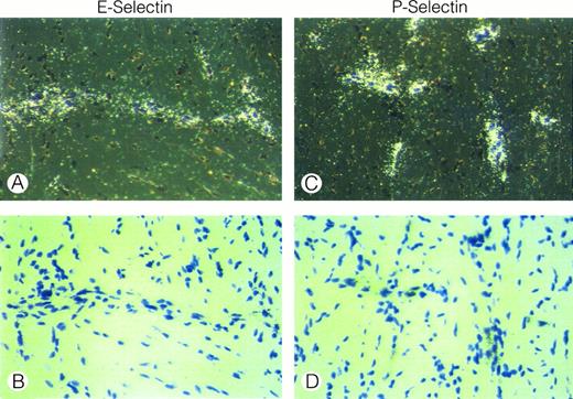 Fig. 8. E- and P-selectin gene expression is induced in peripheral vessels outside the CNS after injection of LPS or TNF-α. In situ hybridization analysis of E- and P-selectin mRNA expression in the tongue of a SJL/J mouse 4 hours after injection of 50 μg LPS is shown. (a), dark field; (b), bright field; (c), dark field; (d), bright field. Sections are counterstained with toluidine blue. Original magnification × 480.