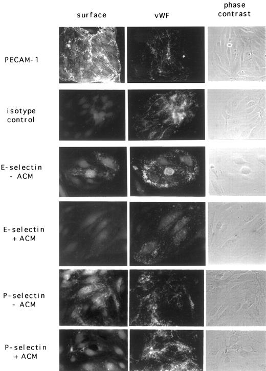 Fig. 9. Induction of E- and P-selectin on primary MBEs in vitro. The same cells are shown from left to right: surface, green fluorescence membrane–staining of live MBEs; vWF, red fluorescence–staining of intracellular vWF in fixed MBEs. E- and P-selectin can be induced on the surface of some vWF-positive MBEs after treatment with LPS (10 μg/mL; 3 hours). No LPS mediated induction of E- and P-selectin when MBEs were cultured in astrocyte conditioned medium (+ ACM) for 5 days. Original magnification × 400.