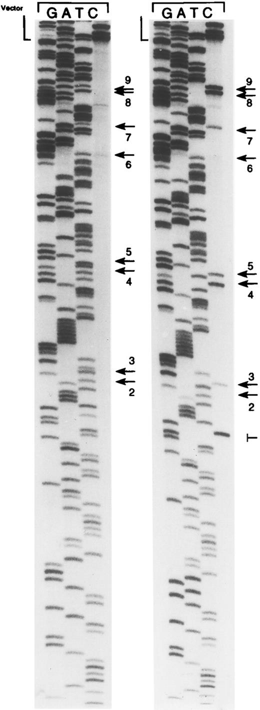 Fig. 2. Representative bisulfite sequencing autoradiogram showing cloned inserts of PCR-amplified bisulfite-treated DNA from PBMCs from donor 2. Examples of cloned inserts with and without methylation of CpG sites in the EBNA-2 responsive region of the C promoter are shown. Arrows indicate CpG dinucleotides. ‖─, a Taq polymerase error. Unmethylated CpG sites are displayed as TpG as a result of the bisulfite treatment, whereas methylated CpG sites are displayed as CpG. CpG sites are numbered as in Table 1. Site no. 1 is not shown. The vector/insert boundary is denoted as vector.