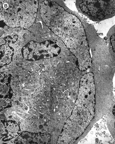 Fig. 2. Morphologic examination of syncytia in HHV-7–infected SupT1 cultures (8 day pi) by light (A) and electron (B through E) microscopy. (A) Field with three syncytia and various single cells. (B) Multinucleated syncytium with an intact morphology. (C) Particular of a necrotic syncytium with vacuolized cytoplasm and initial discontinuation of the plasma membrane. Also note the lack of nuclear chromatin condensation. In (B) and (C), virions appear as dark points (asterisks). (D) Ringed nucleocapsids with an electron-dense core in the cytoplasm of a necrotic syncytium. (E) Particular of a syncytium in advanced stage of necrosis (bottom left), releasing mature virions (asterisks) in proximity of an intact cell (top right). N, nucleus; cy, cytoplasm; v, vacuole; pm, plasma membrane. Original magnifications: (A) ×400; (B and C) ×6,000; (D) ×36,000; and (E) ×7,000.
