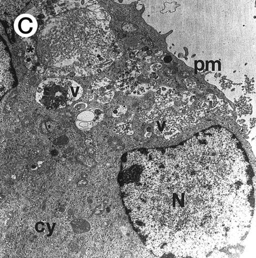 Fig. 2. Morphologic examination of syncytia in HHV-7–infected SupT1 cultures (8 day pi) by light (A) and electron (B through E) microscopy. (A) Field with three syncytia and various single cells. (B) Multinucleated syncytium with an intact morphology. (C) Particular of a necrotic syncytium with vacuolized cytoplasm and initial discontinuation of the plasma membrane. Also note the lack of nuclear chromatin condensation. In (B) and (C), virions appear as dark points (asterisks). (D) Ringed nucleocapsids with an electron-dense core in the cytoplasm of a necrotic syncytium. (E) Particular of a syncytium in advanced stage of necrosis (bottom left), releasing mature virions (asterisks) in proximity of an intact cell (top right). N, nucleus; cy, cytoplasm; v, vacuole; pm, plasma membrane. Original magnifications: (A) ×400; (B and C) ×6,000; (D) ×36,000; and (E) ×7,000.