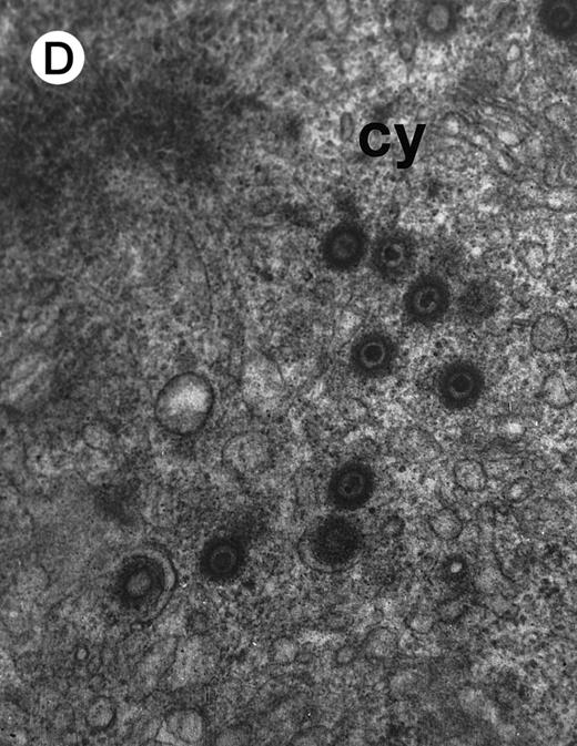 Fig. 2. Morphologic examination of syncytia in HHV-7–infected SupT1 cultures (8 day pi) by light (A) and electron (B through E) microscopy. (A) Field with three syncytia and various single cells. (B) Multinucleated syncytium with an intact morphology. (C) Particular of a necrotic syncytium with vacuolized cytoplasm and initial discontinuation of the plasma membrane. Also note the lack of nuclear chromatin condensation. In (B) and (C), virions appear as dark points (asterisks). (D) Ringed nucleocapsids with an electron-dense core in the cytoplasm of a necrotic syncytium. (E) Particular of a syncytium in advanced stage of necrosis (bottom left), releasing mature virions (asterisks) in proximity of an intact cell (top right). N, nucleus; cy, cytoplasm; v, vacuole; pm, plasma membrane. Original magnifications: (A) ×400; (B and C) ×6,000; (D) ×36,000; and (E) ×7,000.