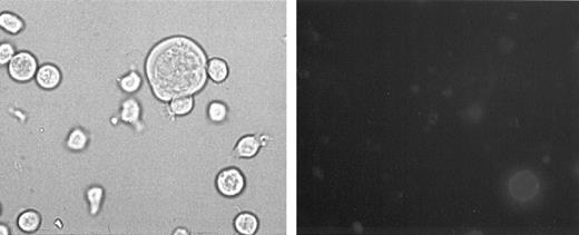 Fig. 3. Evaluation of apoptosis by annexin V staining shown by fluorescence microscopy at day 8 pi. (Left panel) phase contrast light microscopy; (right panel) immunofluorescence microscopy of the same field. Note the presence of one syncytium (left panel) that is negative after annexin V staining (right panel). On the other hand, a single cell in the bottom right part of the photograph shows intense green membrane staining. Original magnification × 400.