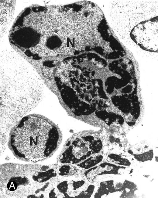 Fig. 6. Ultrastructural examination of apoptotic SupT1 cells by transmission electron microscopy (8 day pi). In (A), two apoptotic nuclei in cells that do not show viral particles. / In (B), note the presence of empty capsids (asterisk) in the cytoplasm of an apoptotic cell (see also the insert at the top left). All cells show chromatin condensation, a characteristic feature of apoptosis. N, nucleus; cy, cytoplasm. Original magnifications: (A) ×4,400 and (B) ×8,800; insert in (B) ×40,000.