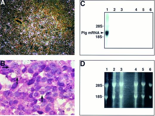Fig. 1. Expression of uPA but not Plg by Lewis lung carcinoma. (A) Darkfield section of a subcutaneous tumor nodule that was hybridized with an antisense probe for uPA. Many of the tumor cells show a strong signal (bright white grains), indicating uPA mRNA expression. (B) Brightfield image of a higher magnification of the tumor cells shown in (A). Although there is cell to cell variability in the expression level of uPA, as shown in (A), the expression of uPA is localized to many of the tumor cells (arrows) forming the tumor nodule. Original magnifications: (A) ×100 and (B) ×650. (C) Northern blot of total RNA from subcutaneous tumors of control mice (lanes 2 and 3) and Plg−/− mice (lanes 5 and 6) inoculated with Lewis lung carcinoma. Lanes 1 and 4 are total liver RNA purified in parallel from a control mouse and a Plg−/− mouse, respectively. The positions of Plg mRNA, 28 S, and 18 S RNA are indicated. (D) Ethidium bromide staining of the agarose gel before blotting.