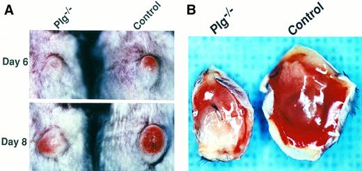 Fig. 2. Plg deficiency reduces primary tumor size, skin ulceration, and hemorrhaging of Lewis lung carcinoma. (A) Representative examples of the macroscopic appearance of primary tumors in a Plg−/− mouse (left panels) and a control mouse (right panels) at day 6 (upper panel) and day 8 (lower panel) after tumor cell injection. Note that the tumor in the Plg−/− mouse is markedly smaller and displays reduced skin redness. (B) Representative examples of subcutaneous hemorrhaging in a Plg−/− mouse (left) and a control mouse (right). Mice were killed at day 11 and perfusion fixed with paraformaldehyde as described in Materials and Methods, and the primary tumors were excised and photographed with the base of the tumor facing up. Note the marked reduction in free blood in the Plg−/− mouse.