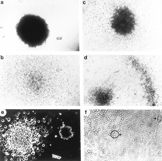 Fig. 4. Morphology of the MTHC colonies. (a through d) Examples of the various types of colonies observed in methylcellulose. Examples shown are indicative of (a) a compact colony, (b) a diffuse colony, (c) a mixed colony with a compact center, and diffuse cells surrounding and (d) a mixed halo colony with a compact center, diffuse cells radiating outward and a compact ring of cells surrounding it. (e and f ) The presence of giant cells in colonies and, for comparison, in liquid culture of Kit-expressing MTHC. (e) Shows the size comparison of a giant cell colony and a normal-sized compact MTHC colony. (f ) The same comparison in liquid culture with the arrows indicating a nonadherent giant cell in the middle of the photograph and an adherent giant cell to the extreme right.
