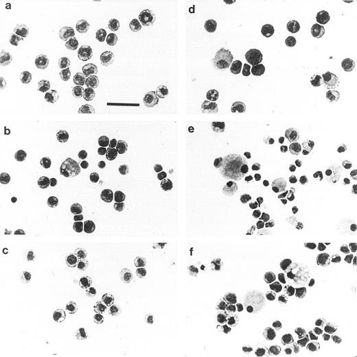 Fig. 5. Morphology of nonadherent (a through c) and adherent (d through f ) populations derived from liquid culture. Cytocentrifuge preparations were stained with Wright-Giemsa. The fields of view shown are representative of the total cell populations. (a and d) Nonadherent and adherent parent MTHC cultured in murine GM-CSF; (b and e) nonadherent and adherent WTKit-expressing MTHC maintained in human SCF; (c and f ) nonadherent and adherent V816Kit-expressing MTHC maintained without factor. The bar in (a) is equivalent to 38 μm and all photographs are at the same magnification.