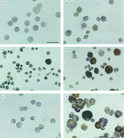 Fig. 6. Esterase expression by the different MTHC populations. The cell groups are the same as those shown in Fig 5. Red staining is indicative of α-naphthyl acetate esterase and blue is indicative of naphtol-AS-D-chloroacetate esterase, with methyl green as the counterstain. (a and d) Nonadherent and adherent parental MTHC cultured in murine GM-CSF, (b and e) nonadherent and adherent WTKit-expressing MTHC maintained in human SCF, and (c and f ) nonadherent and adherent V816Kit-expressing MTHC maintained without factor. The bar in (a) is equivalent to 38 μm and all photographs are at the same magnification.