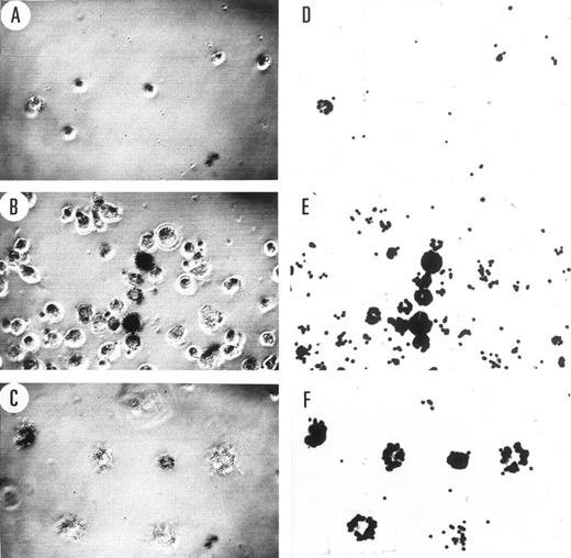 Fig. 7. Phagocytosis of fluorescent beads by adherent MTHC. The images in the two columns are of the same field of view as observed by phase-contrast microscopy shown on the left (A through C) and fluorescence microscopy shown on the right (D through F ). The cells can be seen in the images on the left and the phagocytosed fluorescent beads on the right. The number of the cells in the field of view is indicative of the proportion of cells that were strongly adherent to glass in cultures of similar cell density. (A and D) Show parental MTHC, (B and E) show WTKit-expressing MTHC, and (C and F ) show V816Kit-expressing MTHC. The cells were observed at an initial magnification of 40×.