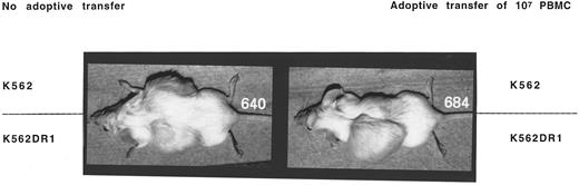 Fig. 2. Adoptive transfer of PBMC prevented tumor formation by K562 or K562β cells, but not K562DR1 cells.