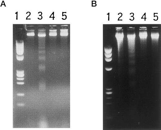 Fig. 10. Inhibition of high molecular weight DNA fragmentation induced by TNF-α. (A) Lane 1, MW marker; 2 and 3, mock-transfected HL-60 cells; 4 and 5, HL-60 transformant NI-1 cells; 2 and 4, without, and 3 and 5, with rhTNF-α for 6 hours. (B) Lane 1, MW marker; 2 and 3, mock-transfected U937 cells; 4 and 5, U937 transformant NJ-1 cells; 2 and 4, without, and 3 and 5, with rhTNF-α for 6 hours.