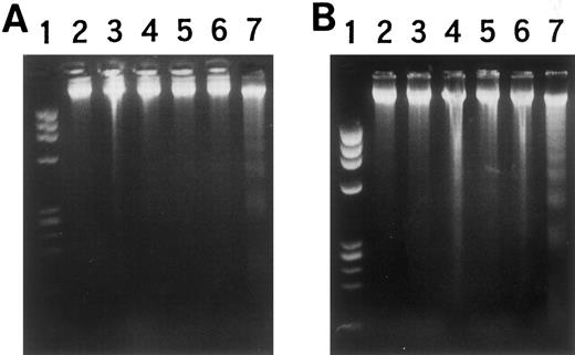 Fig. 7. DNA fragmentation in (A) NG-1 cells and (B) NH-1 cells with IPTG stimulation. (A) Lane 1, MW marker; 2 and 3, wild-type K562 cells; 4 and 5, mock-transfected K562 cells; 6 and 7, NG-1 cells; 2, 4, and 6, without, and 3, 5, and 7, with IPTG for 36 hours. (B) Lane 1, MW marker; 2 and 3, wild-type CMK cells; 4 and 5, mock-transfected CMK cells; 6 and 7, NH-1 cells; 2, 4, and 6, without, and 3, 5, and 7, with IPTG for 36 hours.