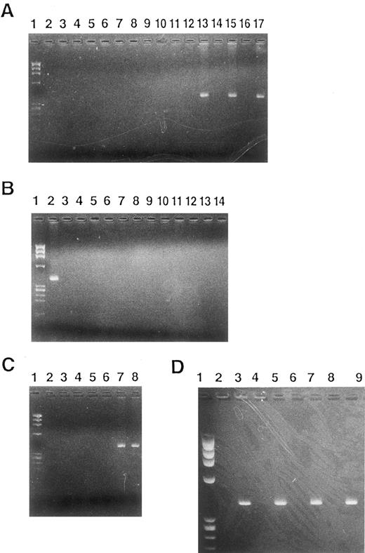 Fig. 8. RT-PCR analysis of MARCO transcript. (A) Lane 1, MW marker; 2, 3, 4, 5, 14, 15, 16, and 17, wild-type HL-60 cells; 6, 7, 8, and 9, mock-transfected HL-60 cells; 10, 11, 12, and 13, NF-1 cells; 2, 4, 6, 8, 10, 12, 14, and 16, without, and 3, 5, 7, 9, 11, 13, 15, and 17, with reverse transcriptase; 2, 3, 6, 7, 10, and 11, without, and 4, 5, 8, 9, 12, and 13, with IPTG for 6 hours; 14 and 15, with RA for 48 hours; 16 and 17, with RA for 84 hours. (B) Lane 1, MW marker; 2, NF-1 cells; 3, 4, 5, and 6, NFS-60 cells; 7, 8, 9, and 10, TF-1 cells; 11, 12, 13, and 14, K562 cells; 3, 5, 7, 9, 11, and 13, without, and 2, 4, 6, 8, 10, 12, and 14, with reverse transcriptase; 3 and 4, with, and 5 and 6, without rhG-CSF for 6 hours; 7 and 8, with, and 9 and 10, without rhGM-CSF for 6 hours; 11 and 12, without, and 13 and 14, with hemin for 96 hours. (C) Lane 1, MW marker; 2 and 3, human bone marrow nonadherent mononuclear cells; 4 and 5, human blood lymphocytes; 6 and 7, human blood neutrophilic granulocytes; 8, NF-1 cells; 2, 4, and 6, without, and 3, 5, 7, and 8, with reverse transcriptase; 8, with IPTG for 6 hours. (D) Lane 1, MW marker; 2, 3, 4, 5, 6, 7, 8, and 9, human blood neutrophilic granulocytes; 2, 4, 6, and 8, without, and 3, 5, 7, and 9, with reverse transcriptase; 2, 3, 6, and 7, incubated for 3 hours, and 4, 5, 8, and 9, incubated for 6 hours; 2, 3, 4, and 5, without, and 6, 7, 8, and 9, with rhG-CSF.