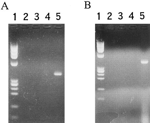 Fig. 9. RT-PCR analysis of MARCO in TNF-α–treated (A) HL-60 and (B) U937 cells. (A) Lane 1, MW marker; 2, 3, 4, and 5, HL-60 cells; 2 and 4, without, and 3 and 5, with reverse transcriptase; 2 and 3, without, and 4 and 5, with rhTNF-α. (B) Lane 1, MW marker; 2, 3, 4, and 5, U937 cells; 2 and 4, without, and 3 and 5, with reverse transcriptase; 2 and 3, without, and 4 and 5, with rhTNF-α.