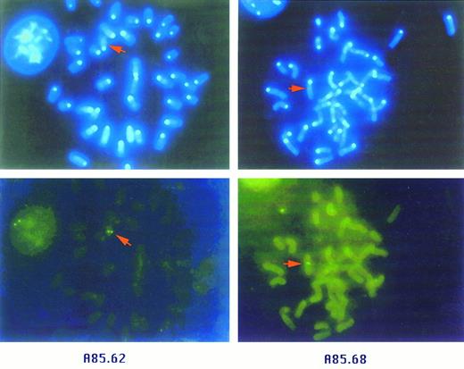 Fig. 3. FISH analysis of β globin YAC transgenic lines. Metaphase spreads from fibroblasts derived from transgenic lines A85.62 (left) and A85.68 (right). Upper panels are photomicrographs of chromosomes stained with DAPI (original magnification 1,000×). Lower panels show fields identical to those in the upper panels, with FITC labeling. β globin YAC sequences have integrated in chromosome 12 in line A85.62 and chromosome 5 in line A85.68.