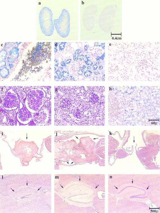 Fig. 1. Histological sections of kidney, liver, heart and brain show hepatic and renal hemosiderosis, renal disease, thrombosis, and infarction in the pathogenesis of both jaundiced and spherocytic mice. Kidney sections (a to e) were stained with Gomori's iron stain and (f and g) with PAS: (a, c, and f ) ja/ja, (b, e, and g) control, (d) sph/sph. Liver section (h) was stained with Gomori's iron stain, ja/ja. Heart sections (i to k) were stained with H&E. Atrioventricular valves are shown as follows: (i) ja/ja and (j) sph/sph, arrows point to thrombi; (k) ja/ja, arrows point to unobstructed valve. Brain sections (l to n) were stained with H&E, hippocampus: (l) ja/ja and (m) sph/sph, arrows point to degenerated hippocampal gyri. Note that the dentate gyri are also degenerating in these mice. (n) same ja/ja as in (l), arrows point to uninfarcted hippocampal gyrus showing unilateral nature of brain infarctions. Bars designate representative size for sections preceding them. Mice: (a, c, f, and i) ja/ja#32, 9.5 months; (b, e, and g) +/+ nonlittermate control to (a, c, f, and i), 9.5 months; (d) sph/sph#163, 3 months; (h, l, and n) ja/ja#43, 3.25 months; (j) sph/sph#110, 4.25 months; (k) ja/ja#46, 3.75 months; (m) sph/sph#73, 4.25 months.