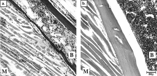 Fig. 2. Peripheral thrombi in the jaundiced and spherocytic mice can cause degeneration of BM and muscle in hind limbs. Bouin's-fixed, paraffin-embedded sections of hind limbs stained with H&E are shown. (a) ja/ja mouse #43 with probable thrombus at aortic bifurcation 3.25 months, (b) +/+ nonlittermate control 6 months old. B, bone marrow; M, muscle.