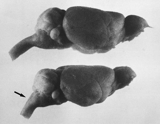 Fig. 3. The steep angle of the brain to spinal cord in jaundiced and spherocytic mice compared with normal, also seen as a sharp angle in the skull, suggests that erythropoiesis in hind region of skull may effect brain shape. Bouin's-fixed, whole brains are shown. Top, normal littermate to ja/ja #9; bottom, ja/ja mouse #9, 5.75 months. The arrow points to spinal cord at sharpened angle. Notice also the steeper slope of the cerebellum.