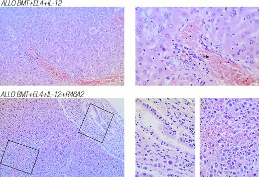 Fig. 4. Neutralization of IFN-γ with MoAb R4-6A2 in leukemic allogeneic BMT recipients treated with IL-12 results in diffuse invasion of leukemic cells and severe GVHD-associated mononuclear cell infiltration of the liver. (Top) Liver was obtained from an IL-12–protected leukemic recipient of allogeneic BMT that died on day 51. (Bottom) Liver was obtained from an IL-12–treated leukemic recipient of allogeneic BMT plus neutralizing anti–IFN-γ MoAb R4-6A2 that died on day 42. 160× and 400× photomicrographs of hematoxylin and eosin stains are shown in left and right panels, respectively.