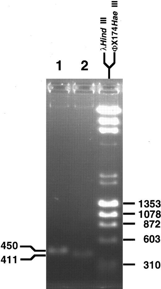 Fig. 4. PCR products obtained with primer sets from MLL and partner DNA encompassing the genomic breakpoint. Direct sequencing in both directions confirmed the translocation breakpoint at nucleotide 3802 in the MLL genomic bcr.