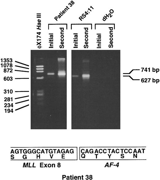 Fig. 6. RT-PCR analysis showing MLL-AF-4 chimeric mRNA. Initial and second round RT-PCR reactions were performed using random hexamer-primed cDNA prepared from total RNA from the leukemic cells of patient 38. Sequences of sense MLL primer from exon 6 and LTG4AS2 antisense primer from AF-4 have been described.18 Four separate initial and second round RT-PCR reactions each gave a single 741-bp product, as shown by example in the figure (top). Direct sequencing of the products of each second round reaction showed an in-frame fusion of MLL exon 8 to AF-4 at position 1459 in AF-4 cDNA19 (bottom). The predicted 627-bp product was obtained in positive control cell line RS4:11 (top). RNA negative controls (dH2O) for initial and second round reactions also are included (top).
