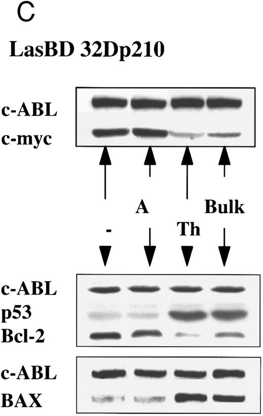 Fig. 3. LasBD suppresses b3a2-mRNA and p210BCR/ABL expression and restores normal function. MO7ep210 or 32Dp210 cells were transduced with LasBD and cultured in IMDM+ 0.25 μmol/L MTX + rHuIL-3 or rMuIL-3 (Bulk) for 14 days. In addition, 1 × 103 transduced cells were cultured in wells of a 48-well plate in IMDM+ 0.25 μmol/L MTX + IL-3 (clones 32Dp210 A and TH and MO7ep210 A and E). (A) Molecular analysis of antisense and BCR/ABL expression: MTX-selected LasBD-32Dp210 and LasBD-M07ep210 cells and untransduced cells were analyzed by semiquantitative RT-PCR to detect AS mRNA, BCR/ABL mRNA, and β-actin mRNA and by Western blot to detect p210BCR/ABL and p145ABL protein, as described in the Materials and Methods. Expression of AS-mRNA and BCR/ABL mRNA as well as p210BCR/ABL protein for untransduced cells (indicated with a minus sign), bulk-selected (indicated as Bulk) and clonal cell populations (for 32Dp210 cells, Th and A; for M07ep210 cells, E and A) are shown. For Western blot analysis, the bands representing the p145ABL protein and the p210BCR/ABL protein are indicated with an arrow. Equal loading of the gels is shown by the presence of the p145ABL protein. (B) Effect of LasBD on growth in the presence and absence of IL-3. (Upper panels) Untransduced 32Dp210 and MO7ep210 cells and transduced, bulk-selected, or cloned 32Dp210 and MO7ep210 cells cultured for 6 days in IL-3–containing medium. On days 1, 3, 5, and 6, the number of viable cells was determined by enumerating cells stained with trypan blue in a hemocytometer. Total viable cell expansion is depicted. Bulk-selected LasBD-32Dp210 and LasBD-MO7ep210 cells and clones 32Dp210-Th and MO7ep210-A expanded significantly less than untransduced 32Dp210 and MO7ep210 cells or clones that continued to express BCR/ABL mRNA and protein (32Dp210-A and MO7ep210-E cells). (Lower panels) Untransduced 32Dp210 and MO7ep210 cells and transduced, bulk-selected, or cloned 32Dp210 and MO7ep210 cells cultured for 6 days without IL-3. On days 1, 3, 5, and 6, the number of viable cells was determined by enumerating cells stained with trypan blue in a hemocytometer. The percentage of viable cells is depicted. All bulk-selected LasBD-32Dp210 cells and LasBD-MO7ep210 cells and clones 32Dp210 -Th and MO7ep210-A died by day 6, whereas a significant proportion of untransduced 32Dp210 and MO7ep210 cells or clones that continued to express BCR/ABL mRNA and protein (32Dp210-A and MO7ep210-E cells) survived even in the absence of IL-3. (C) Untransduced 32Dp210 cells and transduced, bulk-selected, or cloned 32Dp210 cells cultured for 6 days without IL-3 (BCL-2, BAX, and p53) or with IL-3 (C-MYC). After 3 days, cells were recovered and protein extracts were subjected to Western analysis for expression of p145ABL, C-MYC, BCL-2, BAX, and p53. Decreased cell expansion of bulk-selected LasBD-32Dp210 cells and clone LasBD-32Dp210-Th that express only low levels of p210BCR/ABL in the presence of IL-3 was associated with decreased expression of C-MYC (upper panel). Cell death of bulk-selected LasBD-32Dp210 cells and clone LasBD-32Dp210-Th that express only low levels of p210BCR/ABL was associated with increased levels of p53 and BAX and decreased levels of BCL-2 (lower panel).