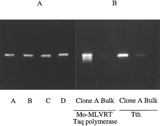 Fig. 4. RT-PCR accurately detect BCR/ABL mRNA levels. (A) Presence of AS mRNA does not impede RT-PCR reaction for BCR/ABL mRNA. mRNA from untransduced 32Dp210 cells was admixed with 0 (lane A), onefold (lane B), fivefold (lane C), or 10-fold (lane D) excess mRNA from LasBD-PA317 cells immediately before the RT-PCR reaction. After reverse transcription with MoMLVRT, cDNAs were amplified for 30 cycles. The addition of up to 10-fold excess LasBD-PA317 mRNA containing the double-copy AS mRNA did not decrease our ability to assess the level of BCR/ABL mRNA in 32Dp210 cells. (B) RT-PCR using Tth or MoMLVRT/Taq polymerase. RT-PCR reaction was performed either at 68°C for 20 minutes using the Tth polymerase or at 37°C for 60 minutes using MoMLVRT/Taq polymerase. mRNA obtained from LasBD-32Dp210 clone A and bulk-selected LasBD-32Dp210 cells was amplified for 30 cycles, and the degree of BCR/ABL mRNA suppression detected using either MoMLVRT or Tth was similar.