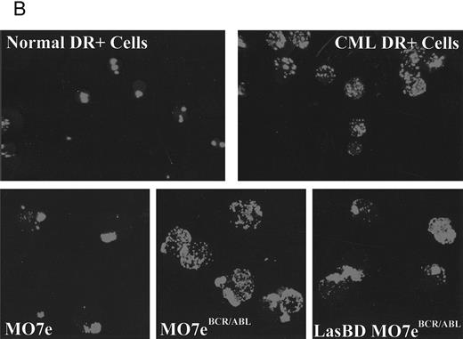 Fig. 5. LasBD restores normal integrin function and expression. (A) MO7e, MO7ep210, and LasBD-MO7ep210 bulk-selected and cloned cells were stained with FITC- or PE-conjugated monoclonal antibodies against CD29 or CD44 and analyzed on a FACStarPLUS flow cytometer. PE- and FITC-conjugated isotype matched mouse IgGs were used as negative controls. Results are presented as the mean ± SEM of four individual experiments. Statistics: Paired Student's t-test: P < .001. (B) Aliquots of 5 to 10 × 104 normal CD34+ cells, primary CML CD34+ HLA-DR+ cells or MO7e, MO7ep210 cells and LasBD-MO7ep210 bulk-selected cells were incubated with an adhesion blocking anti-β1 antibody followed by a goat-antimouse FITC antibody, as described in the Materials and Methods. Cytospin preparations were examined by immunofluorescence microscopy for the presence or absence of integrin caps.