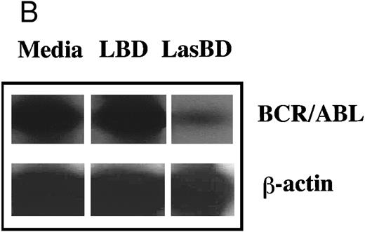 Fig. 7. LasBD suppresses BCR/ABL mRNA in primary CML cells and renders normal and CML progenitors MTX-resistant. (A) 1 × 104 normal or CML CD34+ HLA-DR+ cells were transduced with LasBD or the control vector, LBD containing PA317 supernatants, protamine sulfate, IL-3, IL-6, and SCF in contact with M2-10B4 stromal feeders for 24 hours. Cells were subsequently cultured in serum-free semisolid methylcellulose culture in the presence or absence of 5 × 10−8 mol/L MTX to determine the percentage of MTX-resistant progenitors. Results are represented as the percentage of CFC surviving 5 × 10−8 mol/L MTX from 2 patients with CML (with known b3a2 breakpoint) and 3 normal individuals. (B) 5 × 104 LasBD and LBD-transduced CML CD34+ HLA-DR+ cells were cultured for 14 days in liquid serum-free culture containing 5 × 10−8 mol/L MTX and cells examined by RT-PCR for the presence of the BCR/ABL mRNA.