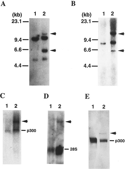 Fig. 2. (A) Southern blot analysis of DNA digested with BamHI and probed with a 1.4-kb BamHI fragment of p300 cDNA probe. As a control, normal peripheral lymphocytes were used (lane 1). The patient exhibits rearranged bands (arrowhead), suggesting that a 1.4-kb BamHI fragment of p300 cDNA spans the translocation breakpoint (lane 2). (B) The same blot was rehybridized with the 0.9-kb BamHI fragment of MLL cDNA (probe x). The patient exhibits rearranged bands the same size as the bands detected with a BamHI fragment of p300 cDNA (arrowhead), suggesting that probe × also spans the breakpoint and that the p300 gene is translocated to the MLL gene. (C) Northern blot of RNAs using a 1.5-kb BamHI fragment of p300 cDNA probe. As a control, normal peripheral lymphocytes were used (lane 1). The patient showed an additional transcript (arrowhead) of approximately 11.5 kb (lane 2). (D) The same blot was rehybridized with the 0.9-kb BamHI fragment of MLL cDNA (probe x). The patient exhibits an aberrant band the same size as the band detected with a BamHI fragment of p300 cDNA (arrowhead). (E) Western blot analysis using p300-specific antibody against the C-terminal of p300. As a control, Namalwa, a Burkitt lymphoma cell line, was used (lane 1). The patient showed an additional polypeptide (arrowhead) of approximately 350 kD (lane 2).