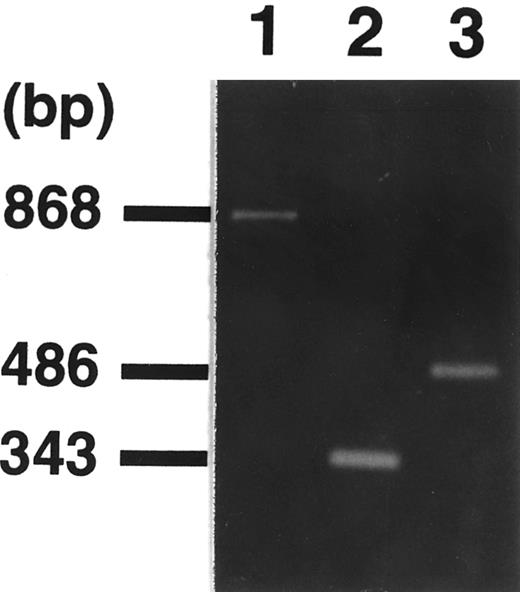 Fig. 3. Identification of fusion transcripts by RT-PCR. Primers used were MLL-7S and p300-8A (lane 1), MLL-9S and p300-7.5A (lane 2), and p300-2S and MLL-11A (lane 3), respectively. Sequencing analysis of the amplified fragment (lane 1) showed a 344-bp fragment of MLL exons 7 through 9 in the 5′ region and 524 bp of p300 exon in the 3′ region. Primers (p300-2S and MLL-11A) were designed for the detection of reciprocal p300-MLL transcript, resulting in the detection of amplified fragment (lane 3).