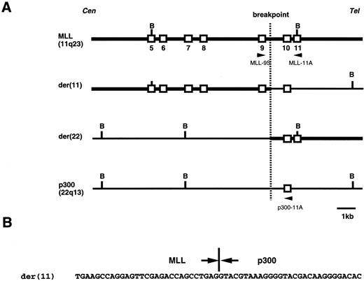 Fig. 5. Genomic analysis of the t(11; 22)(q23; q13) chromosome translocation. (A) Physical map of the t(11; 22) junction in the patient, as well as the corresponding regions from chromosomes 11 and 22. (B) Sequence of the t(11; 22) breakpoint region in the patient. Cen and Tel denote the direction of the centromeres and telomeres of the two chromosomes. Open vertical boxes represent defined exons. Restriction sites: B, BamHI. kb, kilobase.