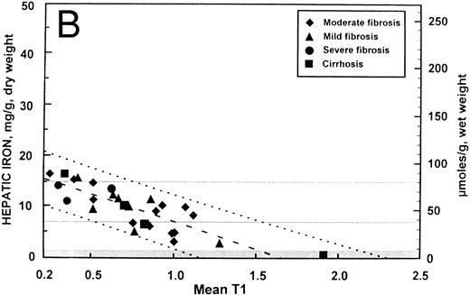 Fig. 2. Relationship between hepatic iron concentration and the SIR of liver to muscle with T1-weighted images derived from GE pulse sequences for patients with SIR greater than 0.2 for patients with no fibrosis (A) or with fibrosis (B). For comparison, the relationship between hepatic iron concentration and the serum ferritin concentration is shown for the same groups of patients without fibrosis (C) and with fibrosis (D).