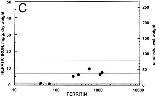 Fig. 2. Relationship between hepatic iron concentration and the SIR of liver to muscle with T1-weighted images derived from GE pulse sequences for patients with SIR greater than 0.2 for patients with no fibrosis (A) or with fibrosis (B). For comparison, the relationship between hepatic iron concentration and the serum ferritin concentration is shown for the same groups of patients without fibrosis (C) and with fibrosis (D).