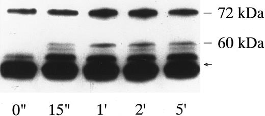 Fig. 1. p72syk-associated tyrosine kinase activity induced by botrocetin-vWF. Platelets suspended in a buffer containing 1 mmol/L Ca2+ were activated with 3 μg/mL of botrocetin and 10 μg/mL of vWF for the indicated time intervals. Reactions were terminated with lysis buffer, and p72syk was isolated by immunoprecipitation with anti-p72syk MoAb. Immunoprecipitates were directly subjected to Western blotting using the antiphosphotyrosine MoAb, 4G10. The arrow represents the band presumably derived from IgG heavy chains. The data are representative of three experiments.
