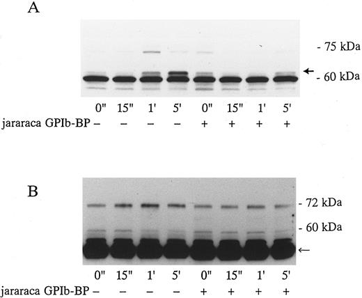 Fig. 3. Effects of jararaca GPIb-BP on PTP of whole cell lysates (A) and p72syk activation (B) induced by botrocetin-vWF. Platelets were incubated with or without 10 μg/mL of jararaca GPIb-BP for 5 minutes and then activated with 3 μg/mL of botrocetin and 10 μg/mL of vWF for the indicated time intervals. For PTP analysis, reactions were terminated with Laemmli SDS buffer, and samples were Western-blotted using antiphosphotyrosine MoAb, 4G10. For analysis of p72syk autophosphorylation, reactions were terminated by adding lysis buffer. p72syk was immunoprecipitated with anti-p72syk MoAb, and the sample was Western-blotted using antiphosphotyrosine MoAb, 4G10. (A) PTP in whole cell lysates. The arrowhead indicates 64-kD PTP. (B) p72syk autophosphorylation. The arrowhead represents the band presumably from IgG heavy chains. The data are representative of three experiments.