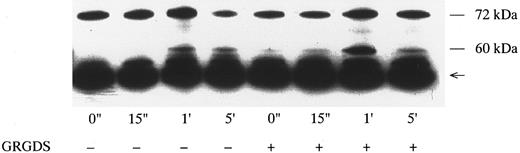 Fig. 4. Effects of GRGDS peptide plus EGTA on p72syk-associated tyrosine kinase activity induced by botrocetin-vWF. Platelets were incubated with or without 200 μmol/L GRGDS peptide plus 1 mmol/L EGTA (instead of Ca2+) for 5 minutes and then activated with 3 μg/mL of botrocetin and 10 μg/mL of vWF for the indicated time intervals. For analysis of p72syk autophosphorylation, reactions were terminated by adding lysis buffer. p72syk was immunoprecipitated with anti-p72syk MoAb, and the sample was Western-blotted using antiphosphotyrosine MoAb, 4G10. The arrowhead represents the band presumably derived from IgG heavy chains. The data are representative of three experiments.