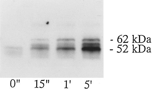 Fig. 5. Time course of Shc tyrosine phosphorylation induced by botrocetin-vWF. Platelets were activated with 3 μg/mL of botrocetin and 10 μg/mL of vWF, and reactions were terminated by adding lysis buffer after the indicated time intervals. Shc was immunoprecipitated with anti-Shc polyclonal Ab. The sample was then Western-blotted using the antiphosphotyrosine MoAb, 4G10. The data are representative of three experiments.