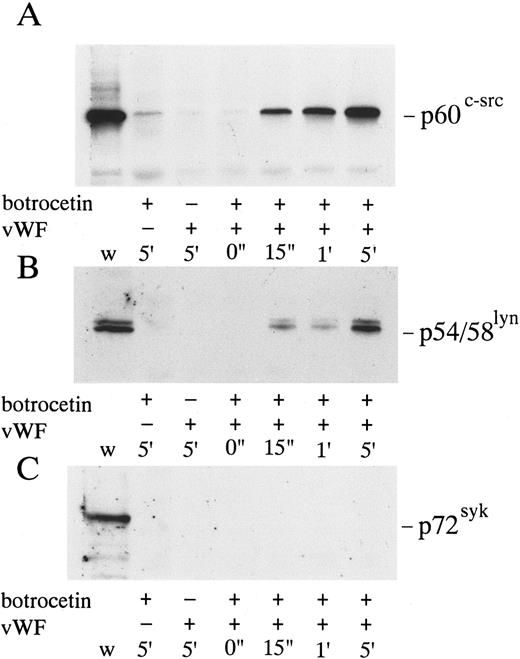 Fig. 7. Cytoskeletal association of p60c-src, p54/58lyn, and p72syk induced by botrocetin-vWF. Platelets were activated with 3 μg/mL of botrocetin and 10 μg/mL of vWF for the indicated time intervals. Reactions were then stopped with lysis buffer, and Triton-X–insoluble fractions were harvested by centrifugation at 16,000g for 5 minutes. The pellets were solubilized with Laemmli buffer. Cytoskeletal association of tyrosine kinases is detected by Western blotting using anti-p60c-src (A), anti-p54/58lyn (B), and anti-p72syk (C) MoAbs. w, whole cell lysates.