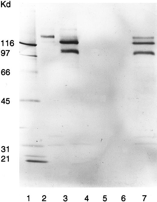 Fig. 3. Immunoprecipitation of platelet membranes by the patient's quinine-dependent antibodies. Donor platelets were surface labeled with NHS-LC-Biotin and immunoprecipitated with MoAb AN51, specific for GPIb (lane 2); MoAb P2, specific for GPIIb/IIIa (lane 3); normal serum (lane 4); normal serum plus quinine (lane 5); patient serum (lane 6); and patient serum plus quinine (lane 7). Immunoprecipitated GPs were analyzed by SDS-PAGE and visualized by ABC-AP Kits plus NBT/BCIP as substrate. Molecular weight standards were included in lane 1.