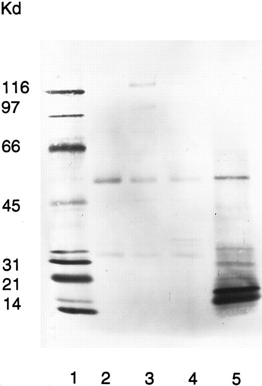 Fig. 4. Immunoprecipitation of neutrophil membranes by the patient's quinine-dependent antibodies. Donor neutrophils were surface labeled with NHS-LC-Biotin, fixed in 1% paraformaldehyde, and immunoprecipitated with normal serum (lane 2), normal serum plus quinine (lane 3), patient serum (lane 4), and patient serum plus quinine (lane 5). Immunoprecipitated neutrophil membrane proteins were analyzed by SDS-PAGE and visualized by ABC-AP Kits plus NBT/BCIP substrate. Molecular weight standards were included in lane 1.