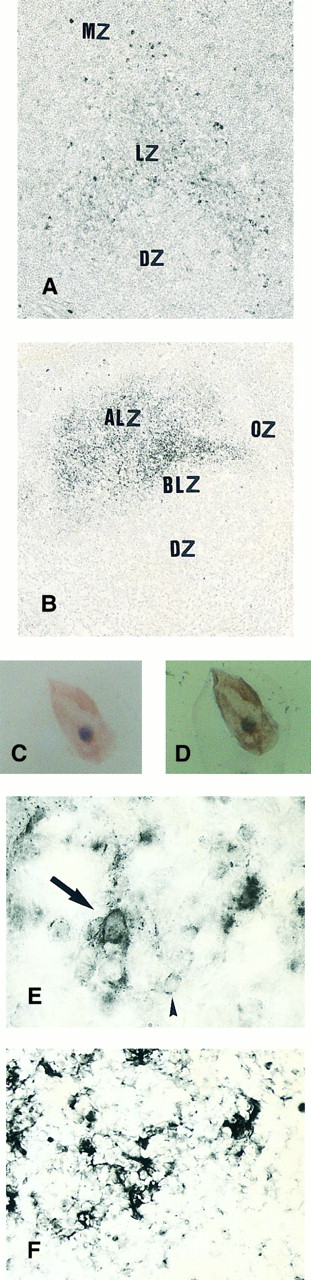 Fig. 1. Expression of TGF-β and TGF-β receptor II in tonsillar lymphoid follicle. (A) Immunostain of TGF-β. There is the reticular and dotted positive stain in the apical and basal light zones but not the other follicular zones. MZ, mantle zone; LZ, light zone; DZ, dark zone. Counterstained with methyl green. Original magnification × 132. (B) Immunostain of TGF-βR II. There is the reticular expression in the apical light zone. OZ, outer zone; ALZ, apical light zone; BLZ, basal light zone; DZ, dark zone. Counterstained with methyl green. Original magnification × 100. (C) Immunocytochemical single staining (red color) of TGF-β on an isolated FDC. Original magnification × 1,280. (D) Double staining of TGF-β and R4/23 on the same FDC. There is a positive signal in the cytoplasm of FDC (brown). Counterstained with hematoxylin. Original magnification × 1,280. (E) In situ hybridization of TGF-β cDNA in the ALZ. Dendritic-shaped cells heavily labeled (arrows). Scattered lymphocytes are also stained (arrowheads). Uncounterstained. Original magnification × 860. (F) In situ hybridization of a TGF-βR II oligonucleotide in the ALZ. Many dendritic-shaped cells are strongly positive. Uncounterstained. Original magnification × 400.