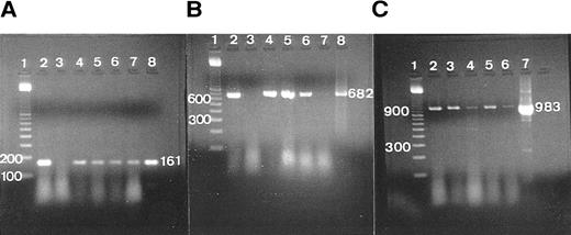 Fig. 2. The RT-PCR expression of TGF-β, GM-CSFRα, and G3PDH. (A) RT-PCR of TGF-β in samples of complete tonsil, germinal center (GC), and extra-germinal center (EGC), showing a single-positive band (161 bp). Lane 1, 100-bp ladder; lane 2, total tonsil (case 1); lane 3, total tonsil except reverse transcriptase (patient 1); lanes 4 and 5, total tonsil (patients 2 and 3); lane 6, GC (patient 4); lane 7, EGC (patient 4); lane 8, primer confirmed as a positive control. (B) RT-PCR of GM-CSFRα in samples of total tonsil and GC, showing a single-positive band (682 bp). Lane 1, 100-bp ladder; lane 2, total tonsil (patient 1); lane 3, total tonsil except reverse transcriptase (patient 1); lanes 4 and 5, total tonsil (patients 2 and 3); lane 6, GC (patient 4); lane 7, EGC (patient 4); lane 8, primer confirmed as a positive control. (C) RT-PCR of G3PDH in samples of total tonsil, GC, and EGC, showing a single-positive band (983 bp). Lane 1, 100-bp ladder; lane 2, total tonsil (patient 1); lanes 3 and 4, total tonsil (patients 2 and 3); lane 5, GC (patient 4); lane 6, EGC (patient 4); lane 7, primer confirmed as a positive control.