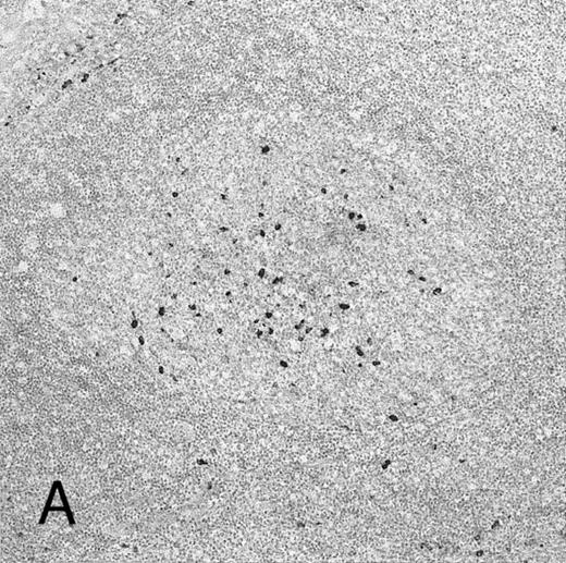 Fig. 3. Expression of GM-CSF and GM-CSFRα in tonsillar lymphoid follicle. (A) Immunostain of GM-CSF. Some positive lymphocytes are scattered in the germinal center, but the distinct reticular pattern was not found. Counterstained with methyl green. Original magnification × 90. (B) Immunostain of GM-CSFRα. The distinct lacy pattern is found in the light zone and often in the outer and mantle zones. MZ, mantle zone; ALZ, apical light zone. Counterstained with methyl green. Original magnification × 240. (C) Immunoelectron micrograph of GM-CSFRα on FDC. Note a positive reaction on the surface of binucleated FDC embracing lymphocyte (L) of FDC. Bar = 1 nm. Original magnification × 5,700. (D) In situ hybridization of GM-CSFRα oligonucleotide. Dendritic-shaped cells are heavily labeled. Uncounterstained. Original magnification × 386.