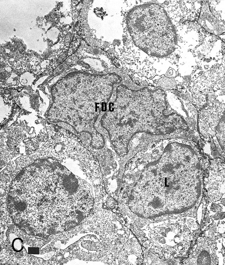 Fig. 3. Expression of GM-CSF and GM-CSFRα in tonsillar lymphoid follicle. (A) Immunostain of GM-CSF. Some positive lymphocytes are scattered in the germinal center, but the distinct reticular pattern was not found. Counterstained with methyl green. Original magnification × 90. (B) Immunostain of GM-CSFRα. The distinct lacy pattern is found in the light zone and often in the outer and mantle zones. MZ, mantle zone; ALZ, apical light zone. Counterstained with methyl green. Original magnification × 240. (C) Immunoelectron micrograph of GM-CSFRα on FDC. Note a positive reaction on the surface of binucleated FDC embracing lymphocyte (L) of FDC. Bar = 1 nm. Original magnification × 5,700. (D) In situ hybridization of GM-CSFRα oligonucleotide. Dendritic-shaped cells are heavily labeled. Uncounterstained. Original magnification × 386.