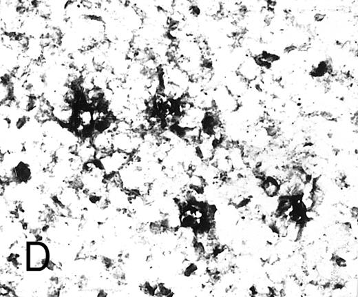 Fig. 3. Expression of GM-CSF and GM-CSFRα in tonsillar lymphoid follicle. (A) Immunostain of GM-CSF. Some positive lymphocytes are scattered in the germinal center, but the distinct reticular pattern was not found. Counterstained with methyl green. Original magnification × 90. (B) Immunostain of GM-CSFRα. The distinct lacy pattern is found in the light zone and often in the outer and mantle zones. MZ, mantle zone; ALZ, apical light zone. Counterstained with methyl green. Original magnification × 240. (C) Immunoelectron micrograph of GM-CSFRα on FDC. Note a positive reaction on the surface of binucleated FDC embracing lymphocyte (L) of FDC. Bar = 1 nm. Original magnification × 5,700. (D) In situ hybridization of GM-CSFRα oligonucleotide. Dendritic-shaped cells are heavily labeled. Uncounterstained. Original magnification × 386.