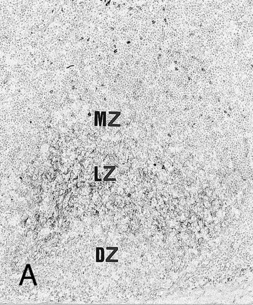 Fig. 4. Expression of TNFR I in tonsillar lymphoid follicle. (A and B) Immunostains of TNFR I. A lacy positive pattern (A) is evident in the apical and basal light zones. High-power view of the basal light zone, showing a heavily labeled lacy pattern (B). MZ, mantle zone; LZ, light zone; DZ, dark zone. (A) Original magnification × 98, (B) Original magnification × 300. (C and D) Immunoelectron micrographs of TNFR I in the tonsillar light zone. The cell surface of a binucleated FDC and the surface of the labyrinth-like structure of FDC embracing lymphocyte (L) are positively stained. Bar = 1 nm. (C) Original magnification × 5,700, (D) Original magnification × 10,080.